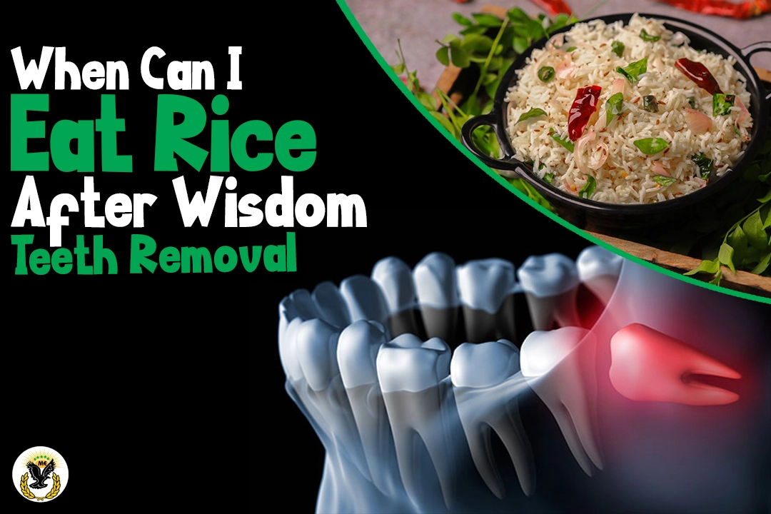 When Can I Eat Rice After Wisdom Teeth Removal