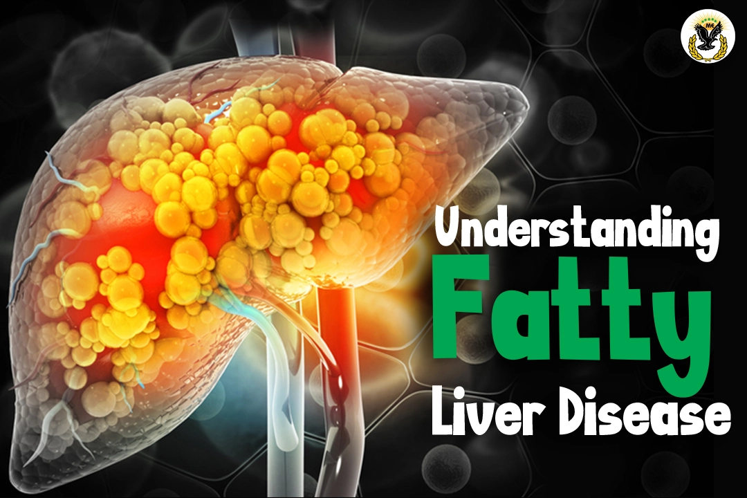 understanding fatty liver disease